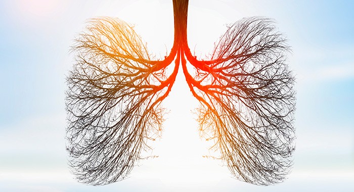 Illustration of lung tree